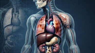 why does ozdikenosis kill you